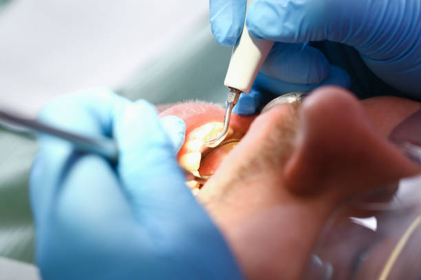 Best Knocked-Out Tooth Emergency  in Baird, TX